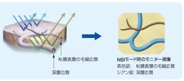 最新鋭の経鼻内視鏡（NBI）を搭載